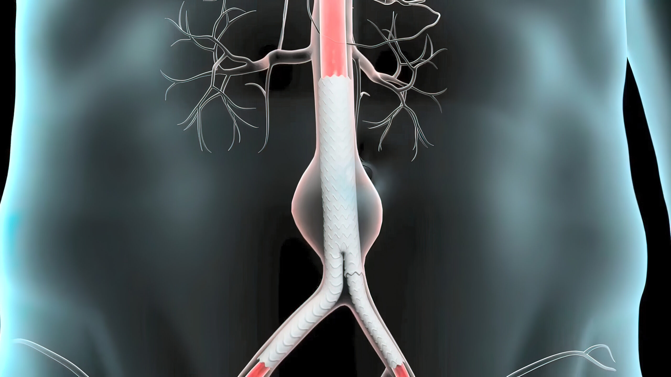 carotid idaho falls