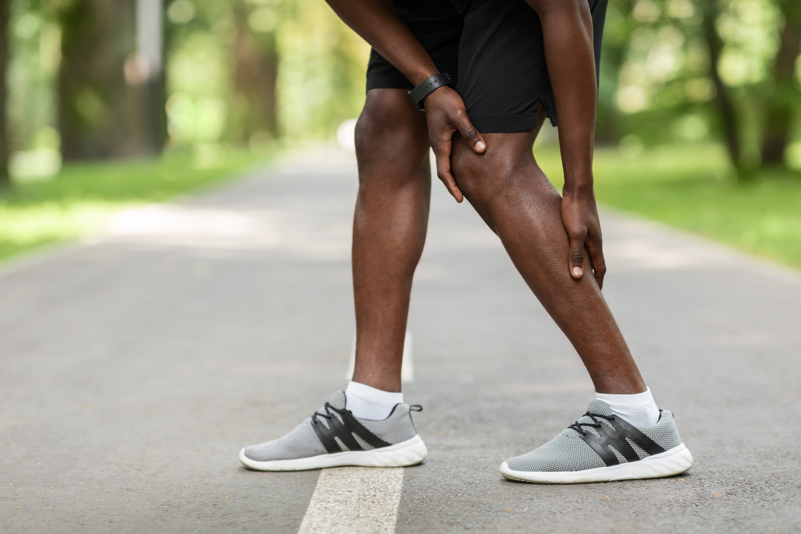 Signs of DVT