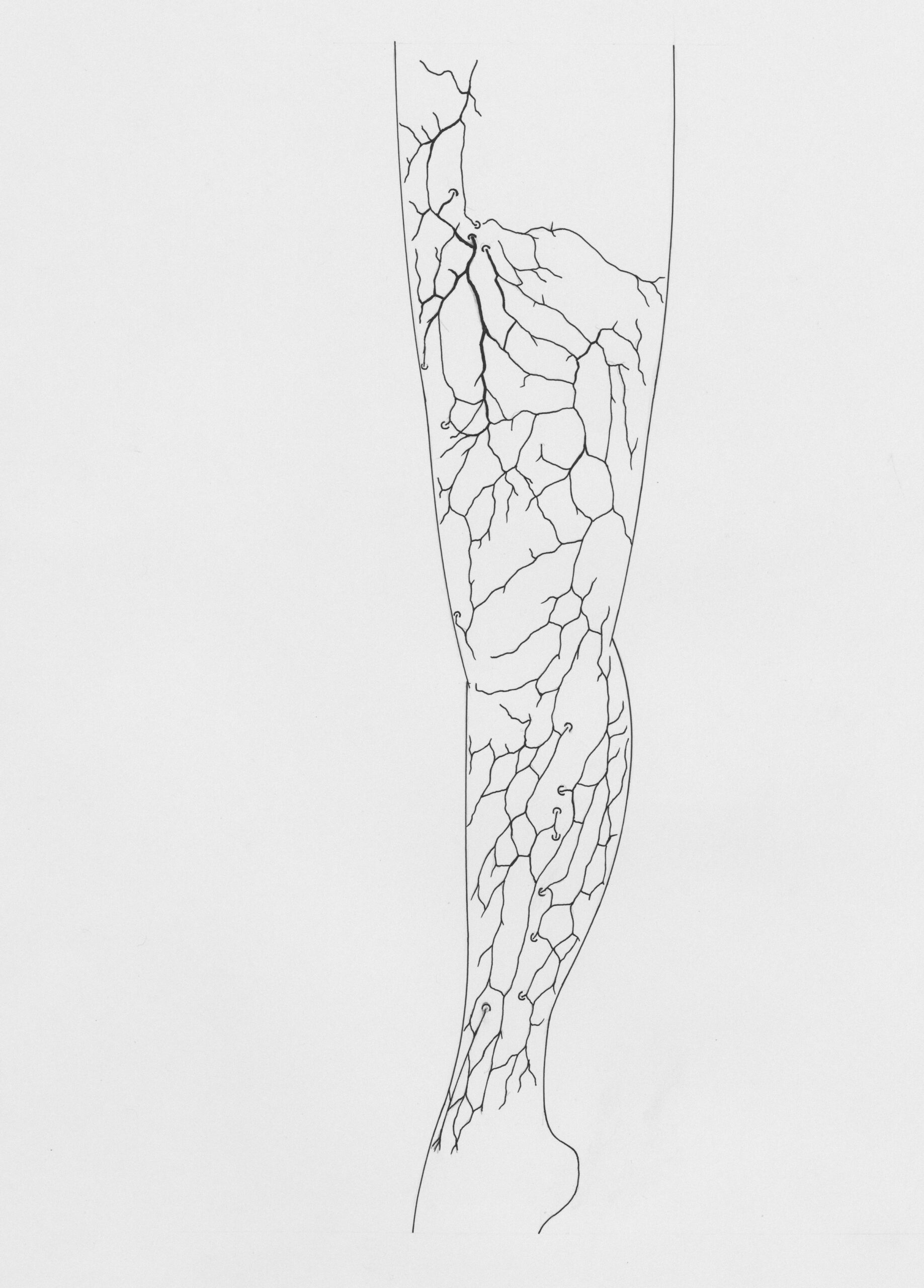 How to Help Leg Wounds Heal Faster